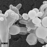 CRYTOCOCCUS
