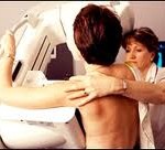 mamografi 6