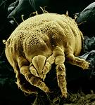 mite 1