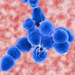 streptococcus_20pneumoniae